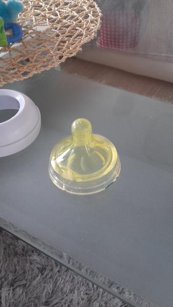 Zežloutlá savička, dá se to odstranit?