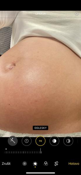 Mohou se metličky pod kůží stát striemi?