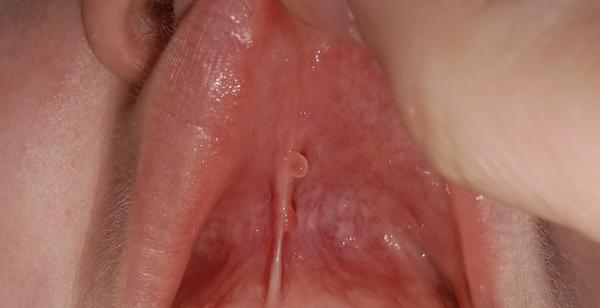 Vyrůstky v ústech. Co by to mohlo být?