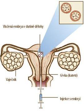 Embryotransfer
