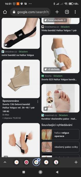 Pomůže bandáž na halux u dcery? Diskutujte zkušenosti