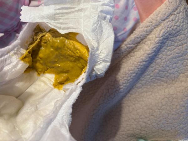 Zhoršení po přechodu na Nutrilon allergy care syneo+. Je to normální?