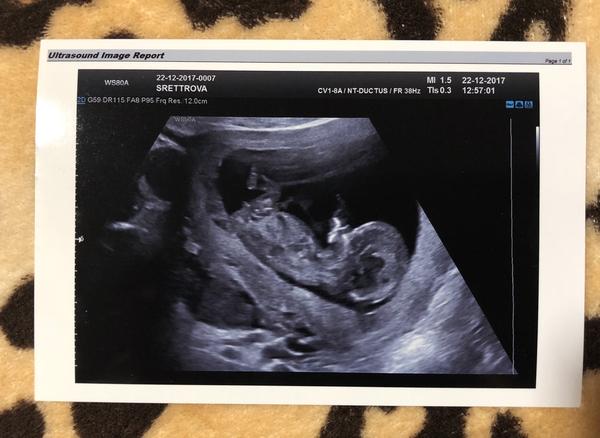 Poznáte pohlaví z fotky?