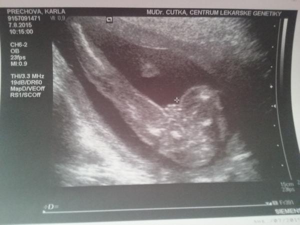 Zajímá mě váš názor. Kluk či holka?