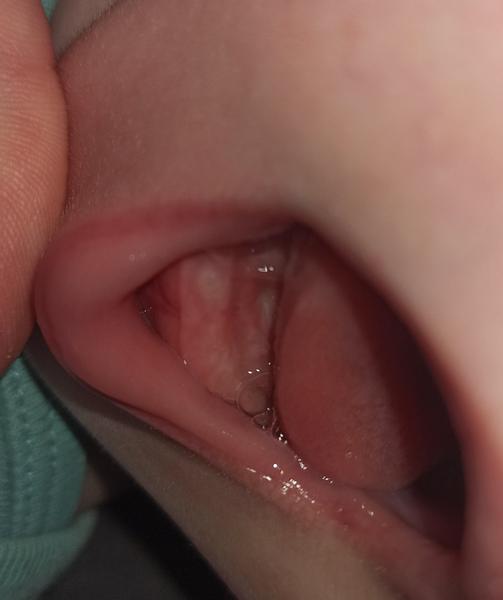 Může miminku v 4,5 měsících růst první zoubek?