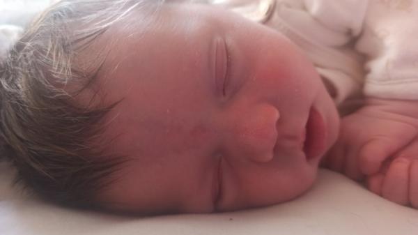 Modřina mezi obočím dítěte. Z čeho a proč se dělá?