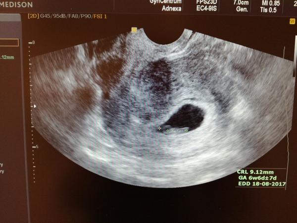 Dnes jsem slyšela srdíčko a jsem vyděšená/šťastná 🙂