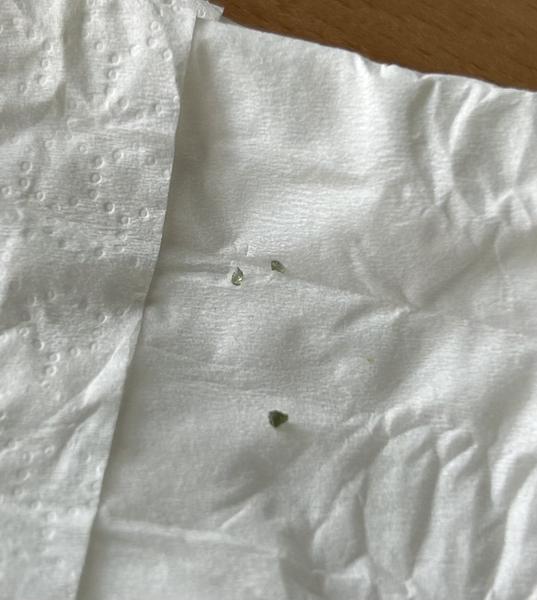 Spolknutí skla u dětí. Jaká jsou rizika?