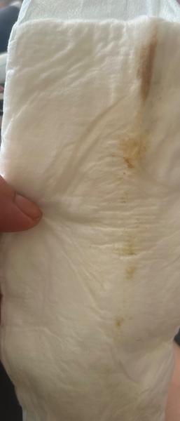 Je to hlenová zátka?