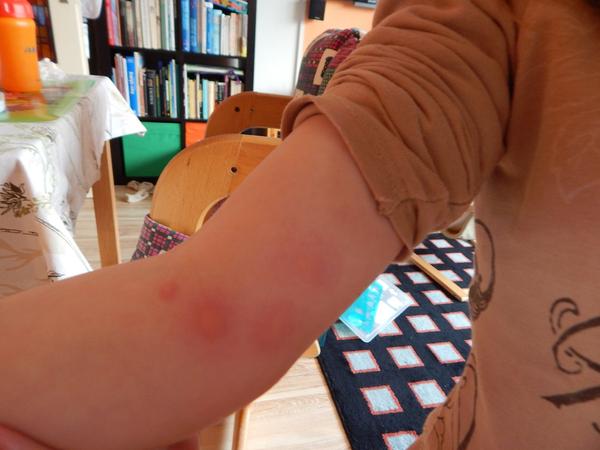 Štípanec nebo kopřivka?