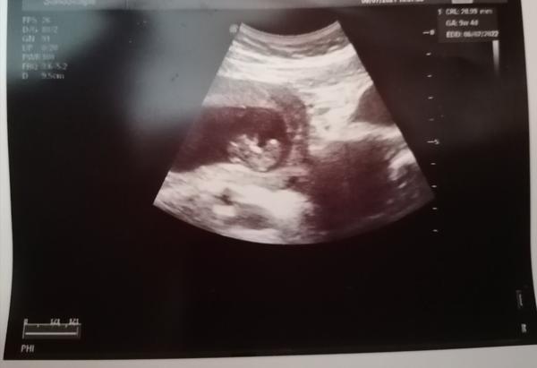 Velikost plodu. Myslíte, že je to ok?