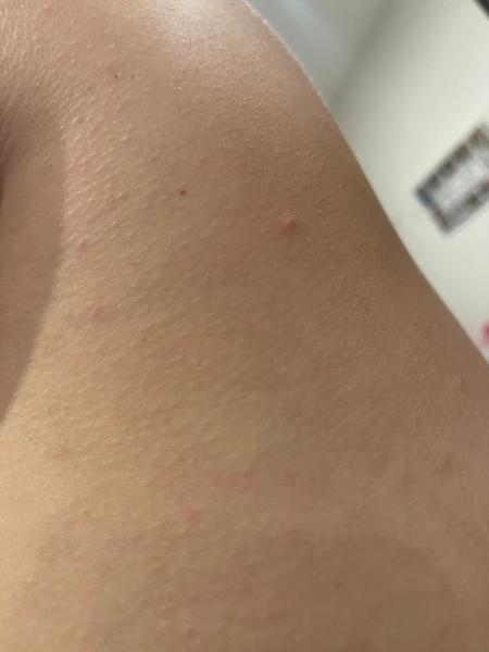 Vyrážka. Co by to mohlo být?