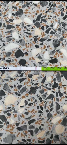 Bolest v podbřišku a těhotenský test. Vidíte druhou čárku?