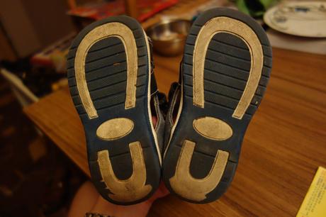 Sandále protetika, protetika,22