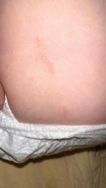 Co má syn na noze a proč se to zvětšuje?