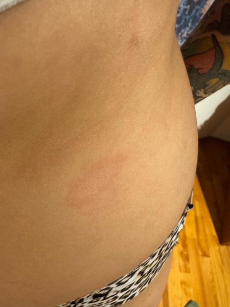 Flek. Co by to mohlo být?