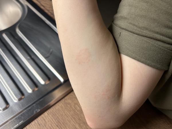 Nevíte, jak řešit kožní problémy po porodu?