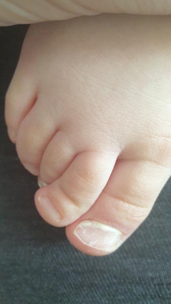 Nehty. O co by se mohlo jednat?