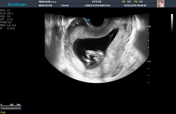 Vidíte holčičku nebo chlapečka?