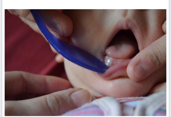 Otekla dáseň. Co by to mohlo být?