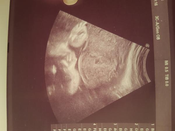 Chytřejší než doktor. Vidíte taky kluka, nebo čekat překvápko?