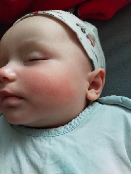 Zčervenání tváře u dítěte: Jaké mohou být příčiny?