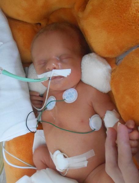 Nedonošeňátka/Předčasňátka