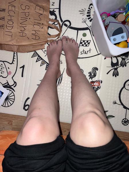 Naštíplé koleno a bolest. Jak poznat zranění?