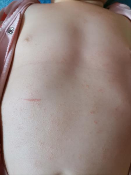 Pupínky. Co by to mohlo být?