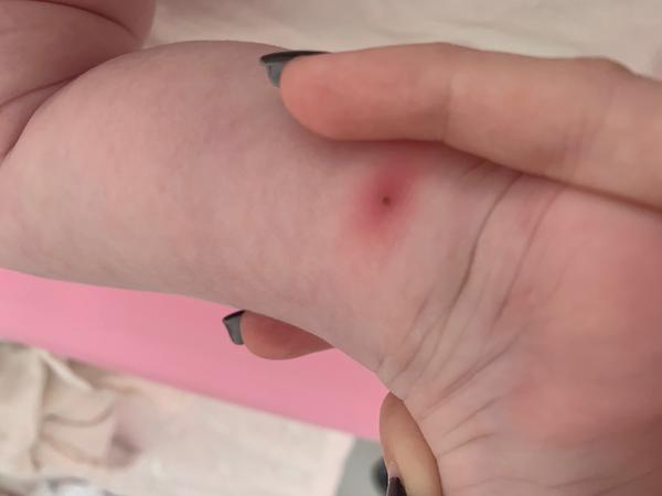 Něco na nožičce. Co to je?