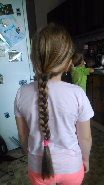 Holé místo ve vlasech u 7leté dcery