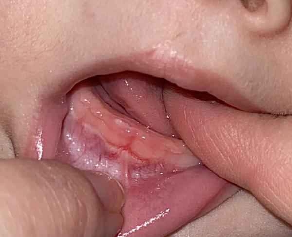 Zoubek? Jak dlouho může trvat, než vyroste?