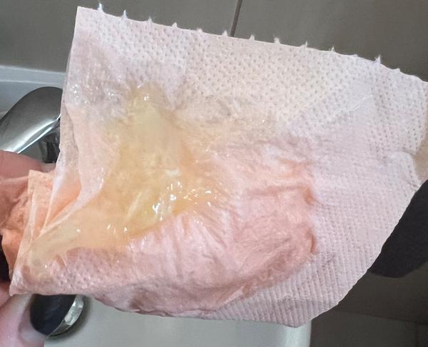 Jedná se o hlenovou zátku?