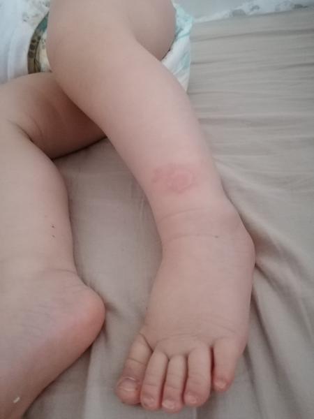 Kopřivka. Máte zkušenost?