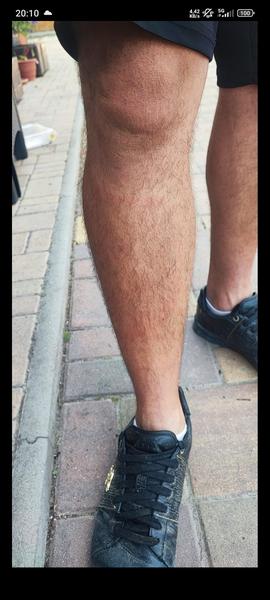 Červené ohraničení na noze. Co by to mohlo být?