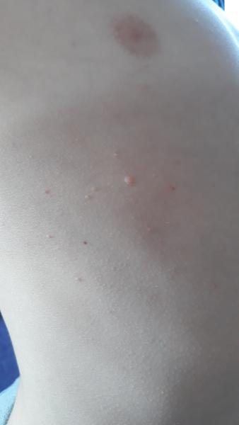 Pupínky. Co by to mohlo být?