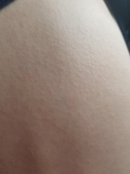 Nevíte, co způsobuje vyrážku u dětí?