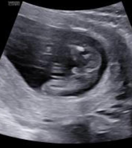 Je to holka nebo kluk? Jak rozeznat z fotky?