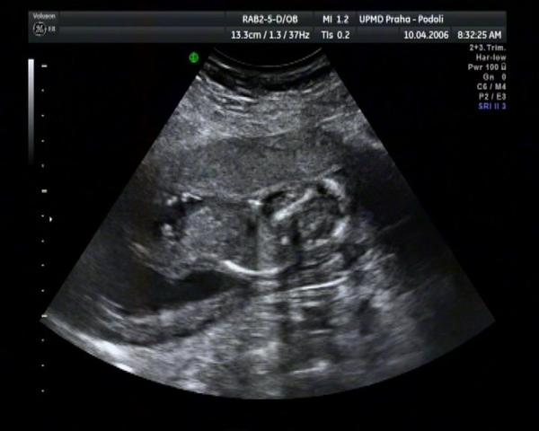 Co si myslíte, že je to za pohlaví?