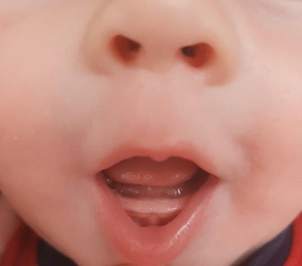 Můžou to být zuby?