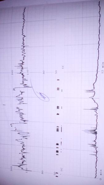 Která z čar je záznam srdce?