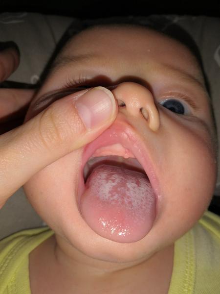 Moučnivka. Může se o ni jednat?