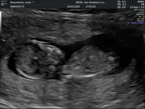 Pohlaví. Tipnete si?