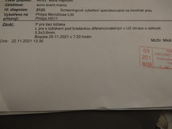 Máte zkušenosti s biopsií prsu? Jaké jsou šance na rakovinu?