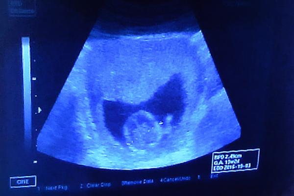 Velikost plodu ve 13. týdnu