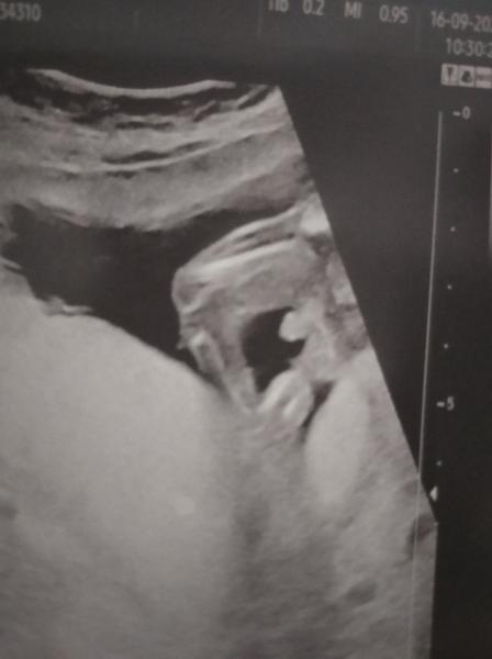 Je to opravdu na 100 % kluk?