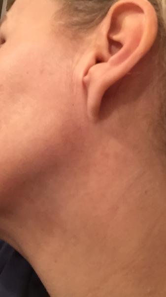 Fleky po celém těle. Co by to mohlo být?