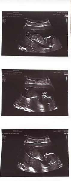 Tipnete si pohlaví z obrázku? Holka nebo kluk?