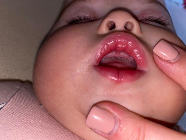 Horečky u miminka. Mohou souviset s prořezáváním zubů?