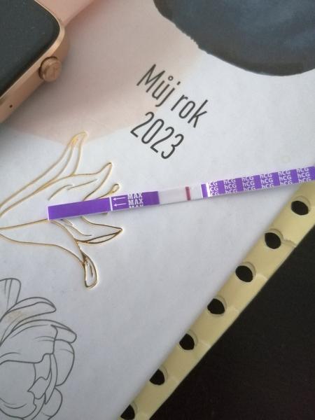 Je něco vidět v TT rentgenu? 